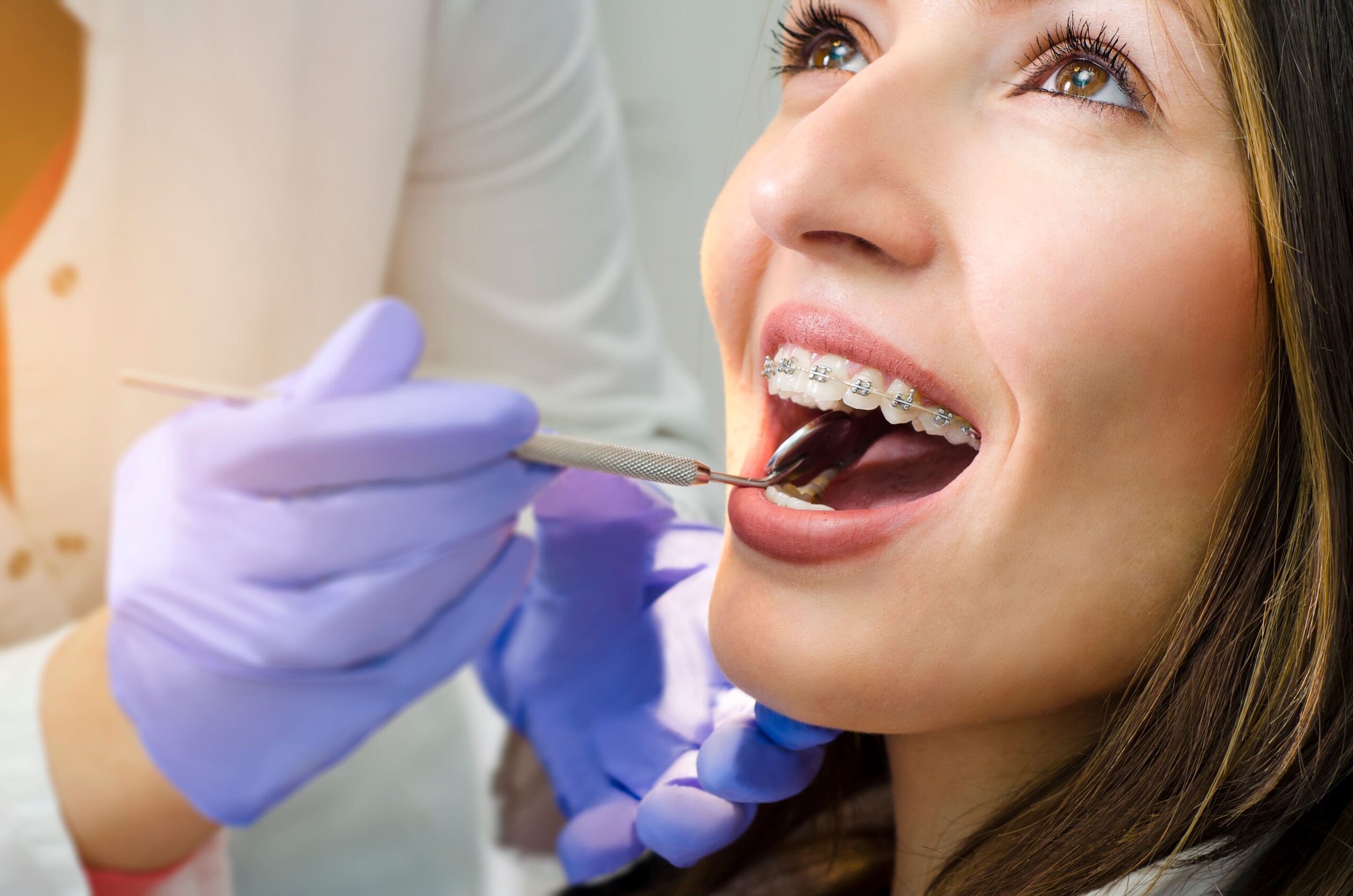 braces orthodontist near Belleville